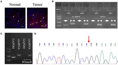 Lcn2-derived Circular RNA (hsa_circ_0088732) Inhibits Cell Apoptosis and Promotes EMT in Glioma via the miR-661/RAB3D Axis